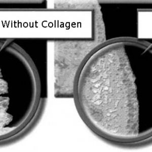 skin with collagen and without